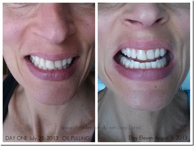 oil pulling before and after